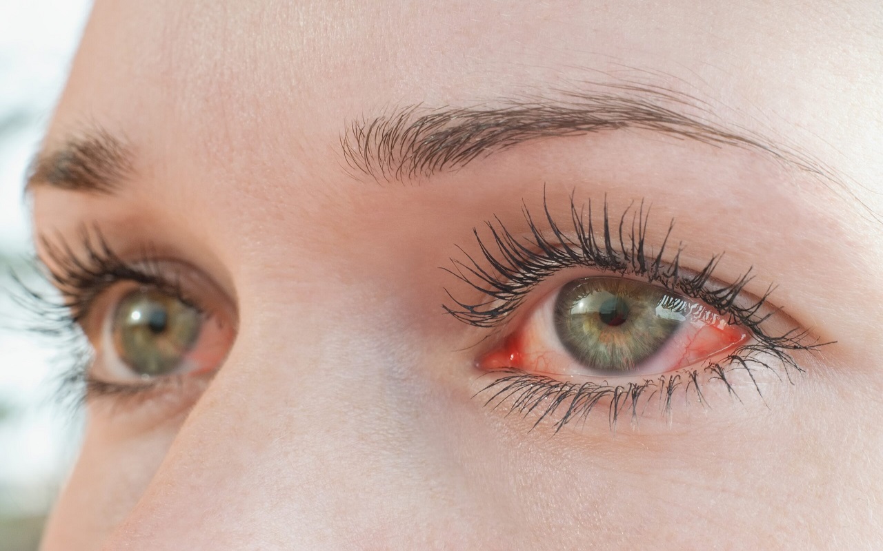 Health Tips: If your eyes always remain red, don't consider it normal, these diseases can happen