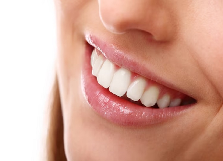 Teeth Whitening Remedy: This mixture of baking soda and salt brightens yellow teeth