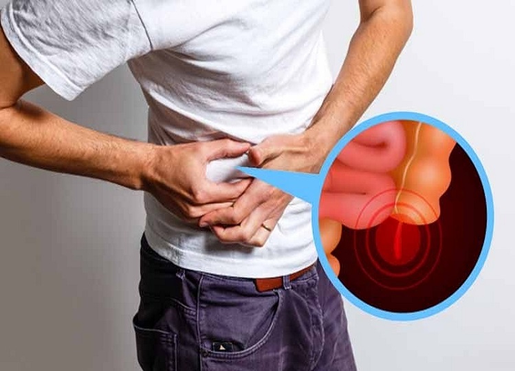 Health Tips: Stomach pain could be appendix, if you get such signs then contact a doctor.