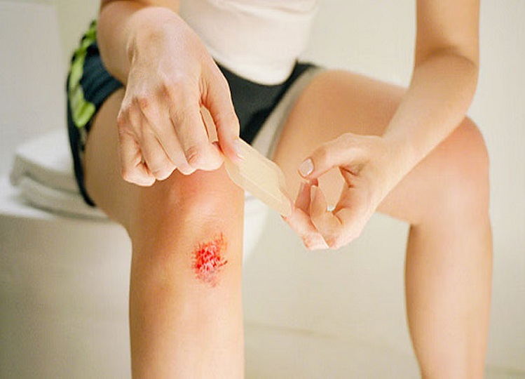 Health Tips: You can also do these measures to heal the wound quickly
