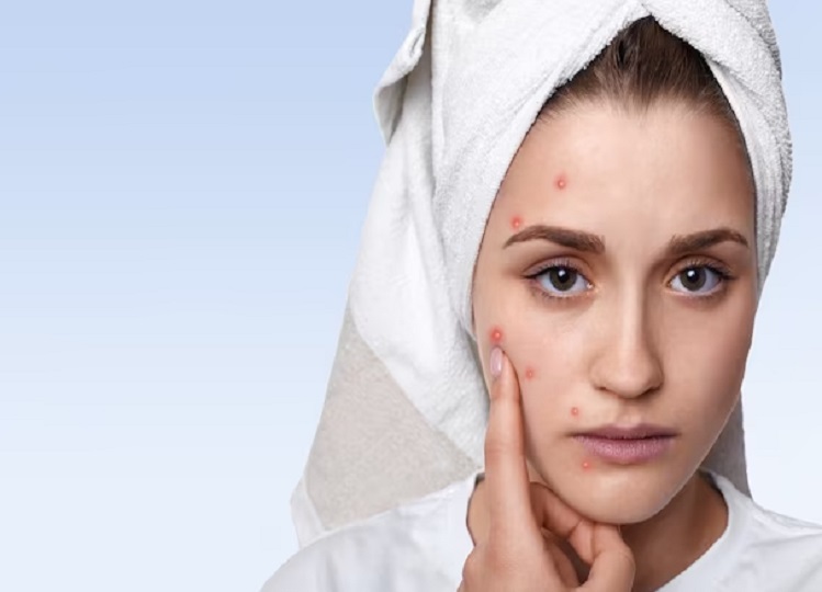 Skin care tips: Try these home remedies in rainy season, you will not have skin related problems