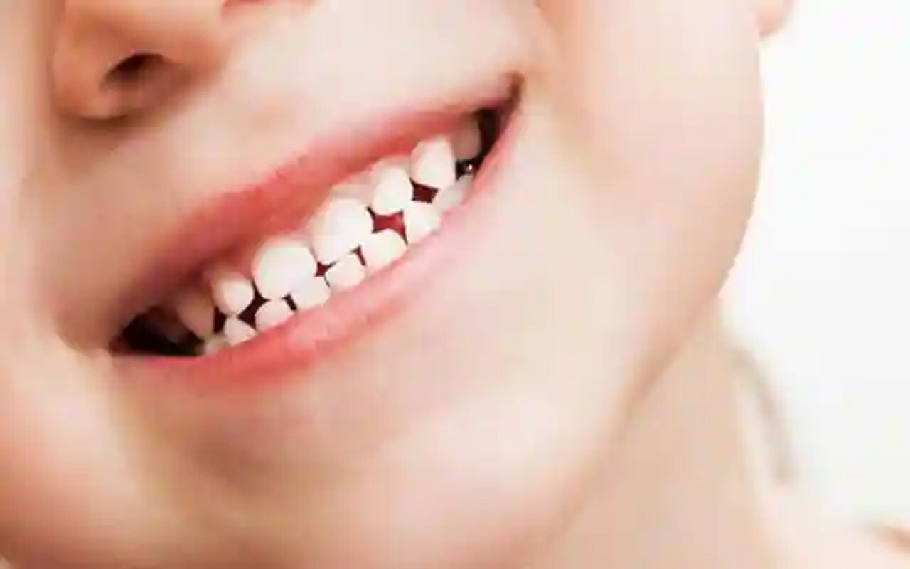 Health Tips: Take care of children's teeth in this way, otherwise they will get spoiled