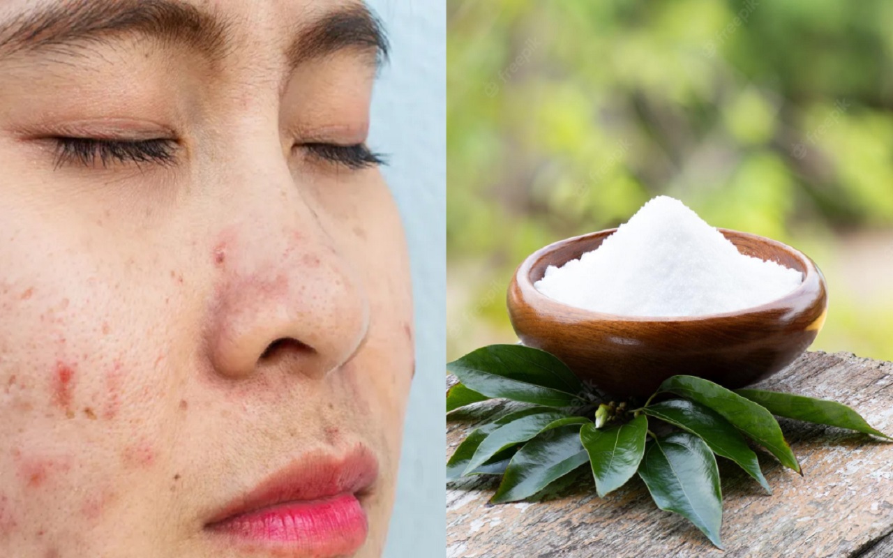 Beauty Tips: Camphor is very beneficial for your skin in summer, you can use it