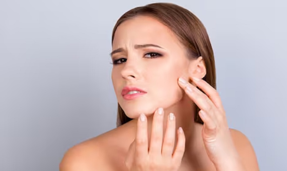 Beauty Tips: Include these things in your diet to get rid of acne problems during monsoon season