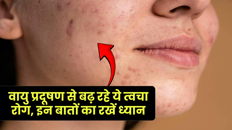 Easy tips to protect your skin from Delhi pollution: Get relief from wrinkles and dark circles!