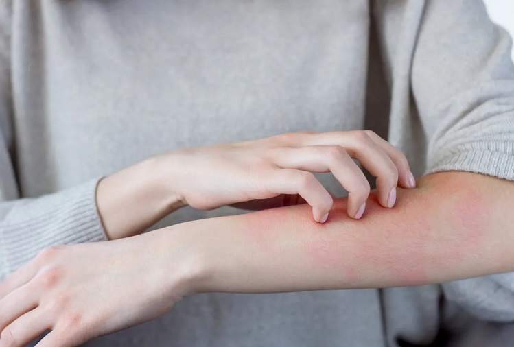 Winter Skin Tpis :  Try these tips to get relief from itching on the skin in cold weather