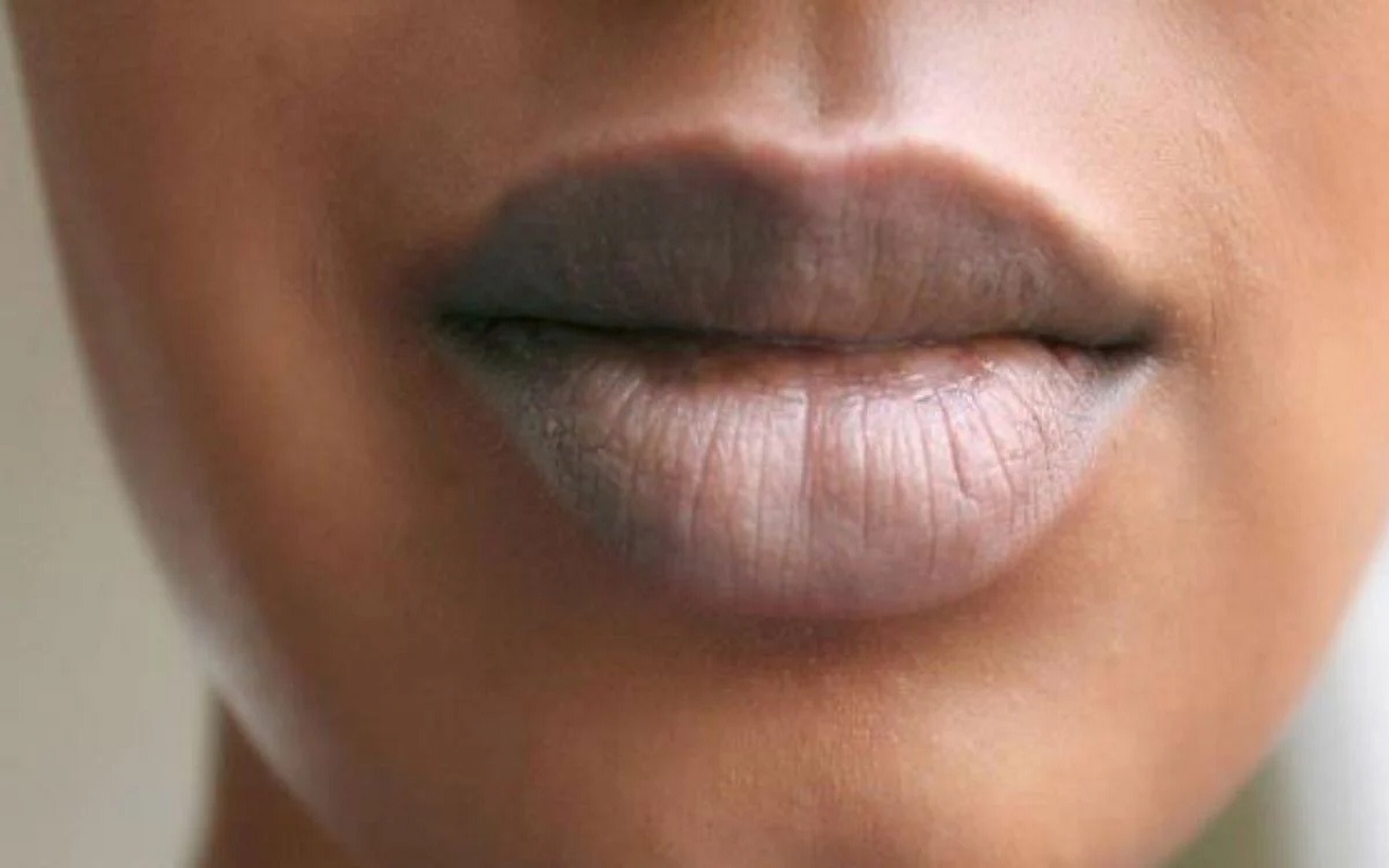 Beauty Tips: If the black color of the lips is spoiling your beauty, then follow these tips