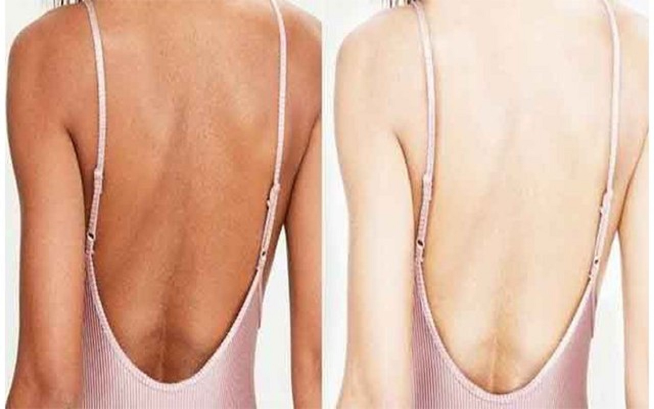 Beauty Tips: You can also remove the blackness of the back, just have to do this work