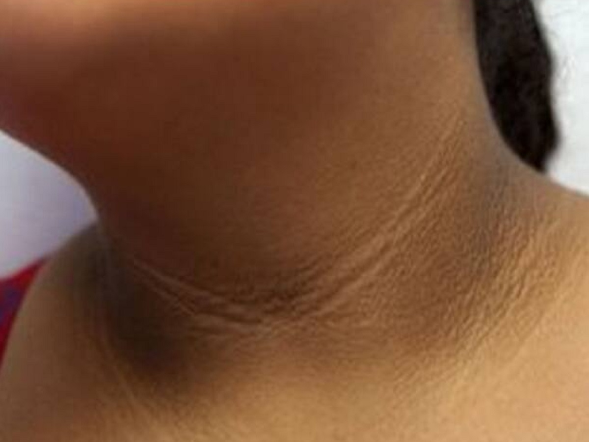 Beauty Tips: Orange peel can remove neck darkness; here’s how to use it