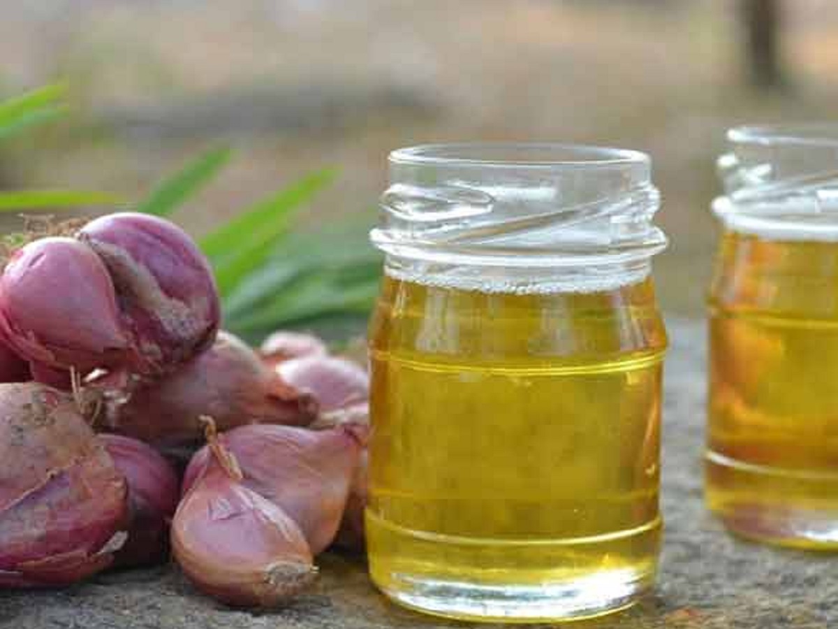 Hair Care Tips: Make onion oil this way, it is very beneficial for hair