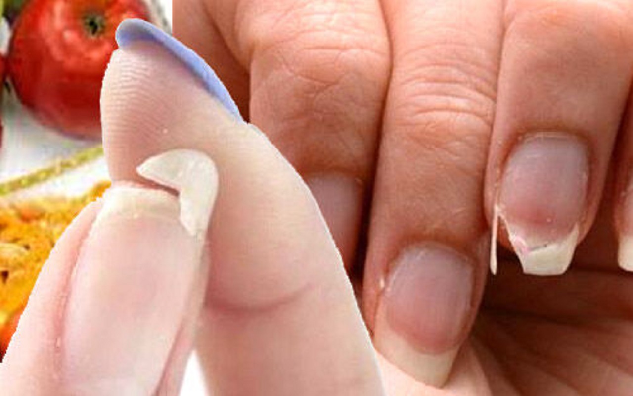 Beauty Tips: If your nails break again and again, then use these things