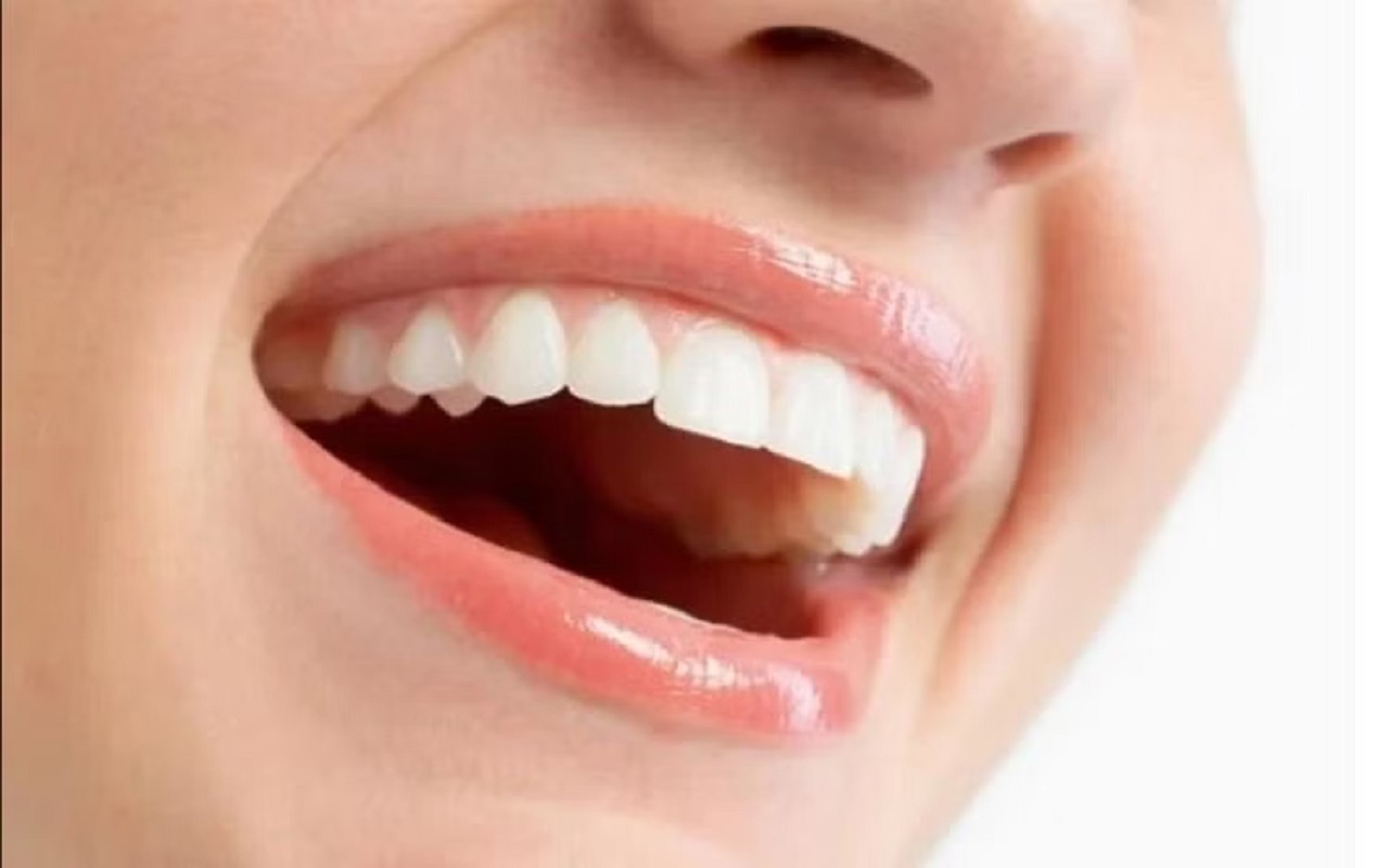 Health Tips: To keep teeth healthy, start eating these things from today itself