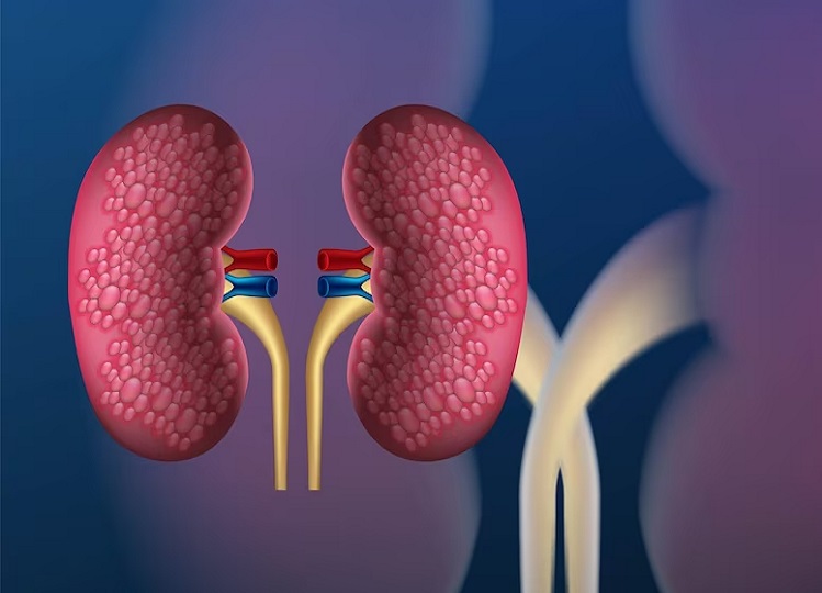 Health Tips: These things are very beneficial for kidneys, include them in your diet