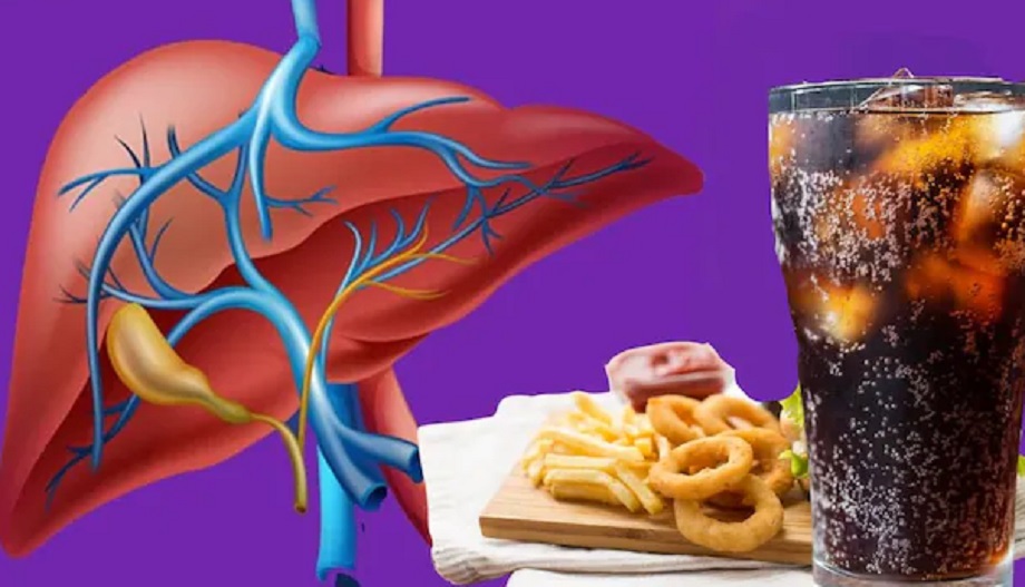 Health Tips: Not only alcohol, these five things also harm the liver, stay away from them from today itself