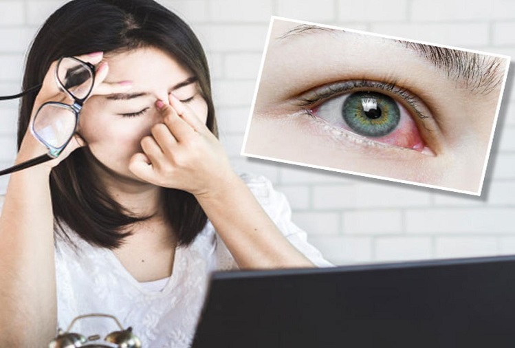 Health Tips : Try these remedies to get rid of eye problems