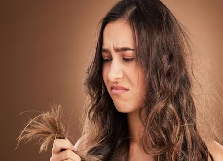 Hair Care Tips: If your hair has become dry and lifeless due to dandruff, then try these home remedies