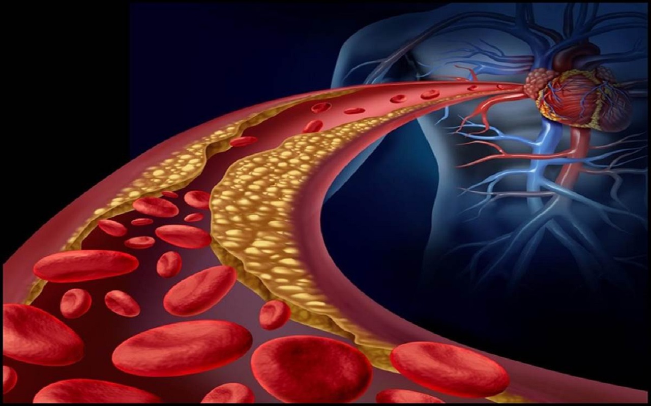 Health Tips: These symptoms will appear when high cholesterol increases, contact the doctor