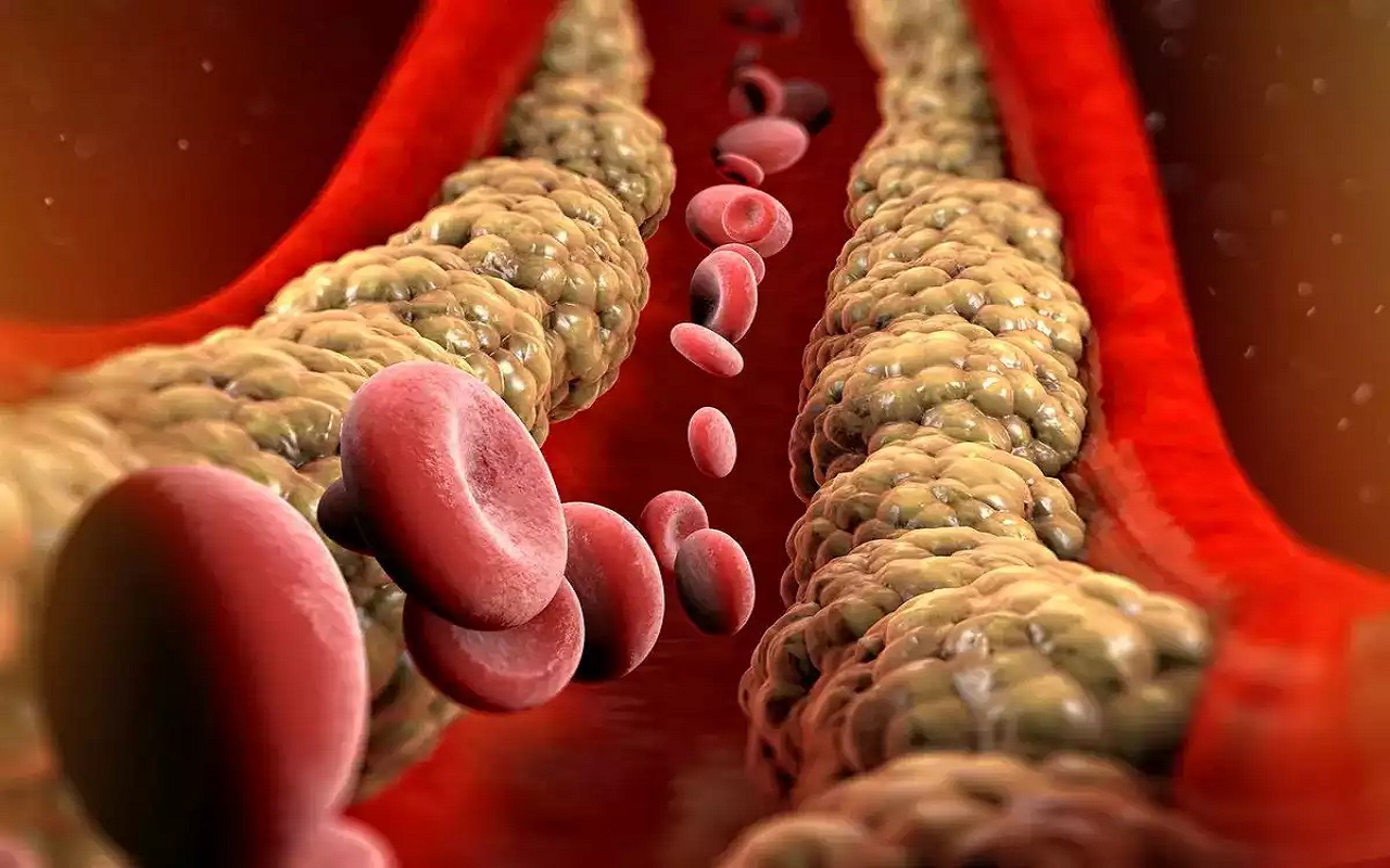 Health Tips: You will also see these symptoms when bad cholesterol increases, do not delay