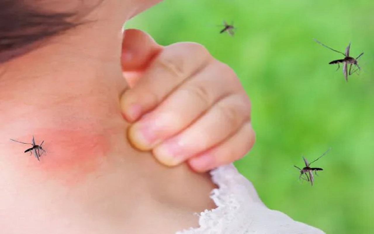 Health Tips: Mosquito bites cause itching and irritation, so you should also follow these tips