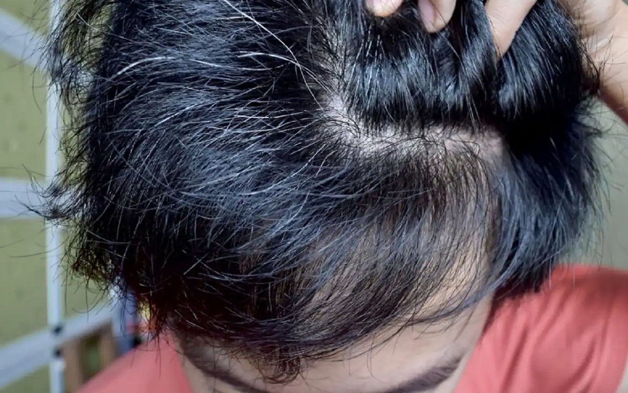 Beauty Tips: If children are getting white hair, then start this treatment from today itself.