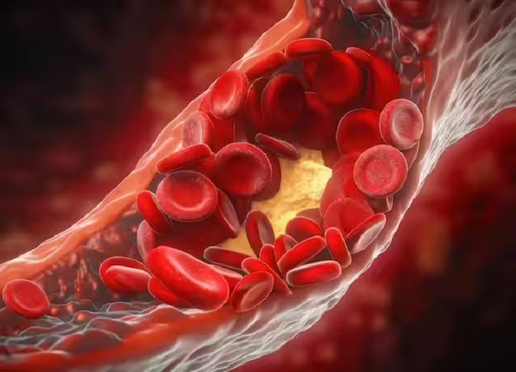 Health Tips: These symptoms appear when cholesterol increases, consult a doctor immediately