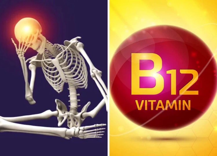 Vitamin B12 Deficiency: Vitamin B12 deficiency will make you a skeleton, if you see these symptoms then contact the doctor