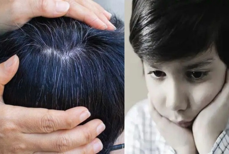 Beauty Tips: If you are troubled by the white hair of children, then follow  these tips, it is very effective| lifestyle News in Hindi | Beauty Tips:  बच्चों के सफेद होते बालों