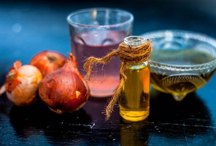 Recipe : Try onion oil for hair growth, know the recipe