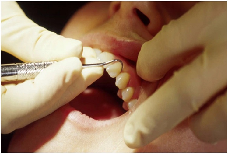 Health Tips: If you are troubled by the problem of teeth, then you can also adopt these tips